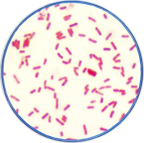 An enhanced microscopic image of plague bacteria. The bacteria appear rose-colored because of a technique called Gram’s Stain, used to confirm a Y. pestis identification. Larry Stauffer, Oregon State Public Health Laboratory, USCDCP Plague-Hunt-bacteria-petri.jpg