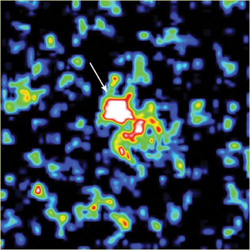 Gamma ray burst