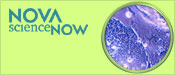 NOVA scienceNOW: Stem Cells Breakthrough