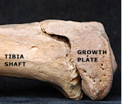 Tibia