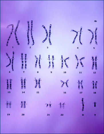 Chromosomes