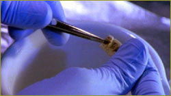 Examining bone fragment with tweezers