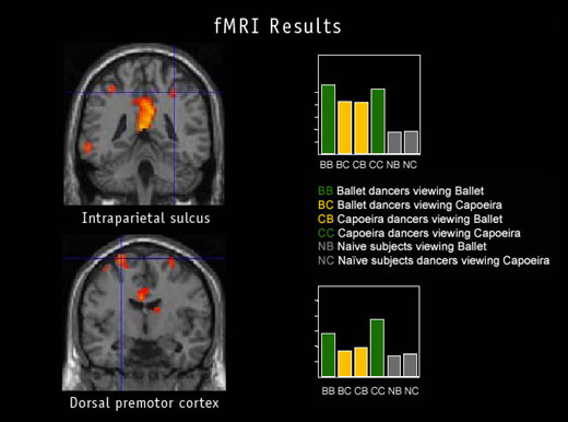 fMRI image