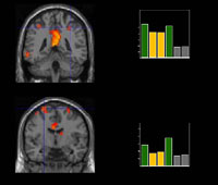 fMRI